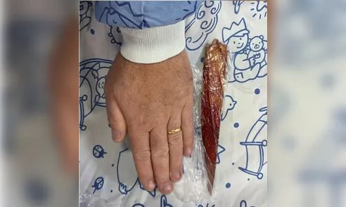 Criança de 9 anos se fere com farpa de 23 cm em ensaio no teatro