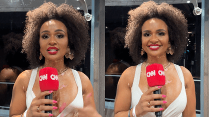 Natália Deodato fala sobre vitiligo e empoderamento após o BBB