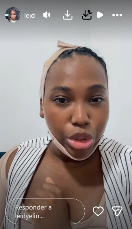Leidy Elin evolui na recuperação após lipoaspiração rápida