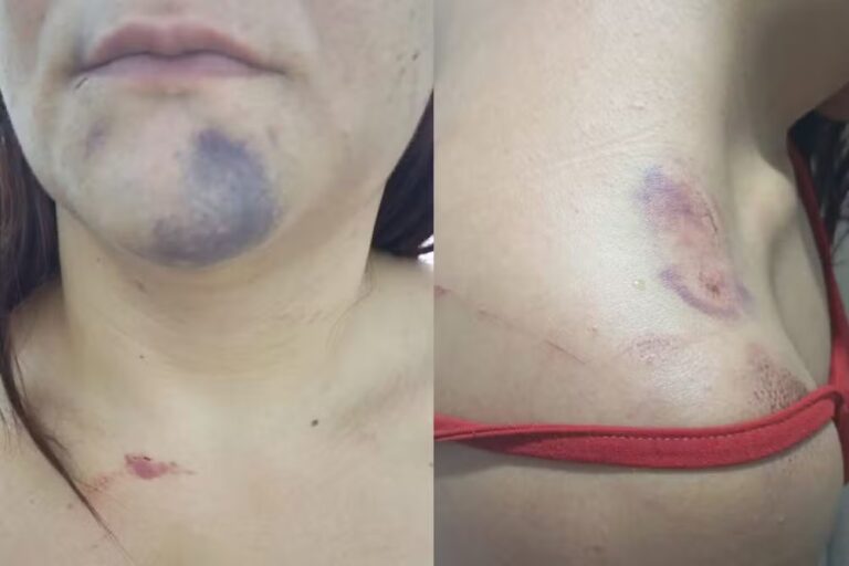 Mulher torturada pelo namorado relata momentos de terror em Terra Rica