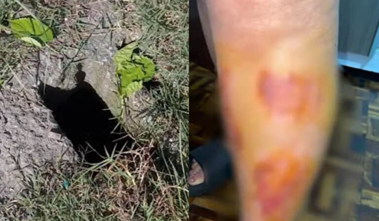Mulher cai em bueiro sem tampa em Curitiba e cobra indenização
