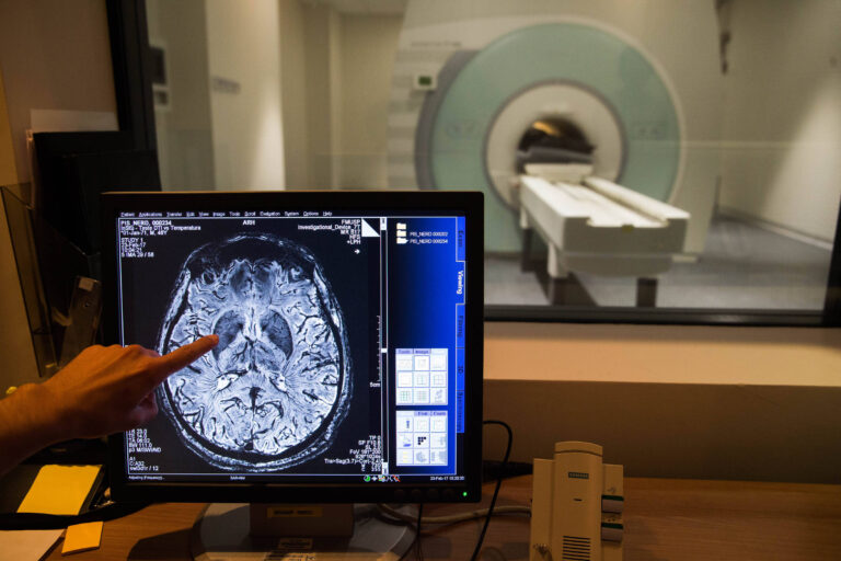 Desenvolvimento cerebral: mito dos 25 anos desvendado pela neurociência