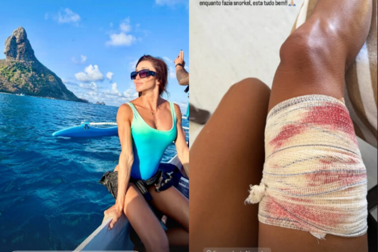 Surfista sofre mordida de tubarão em Fernando de Noronha