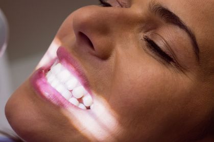 Anvisa proíbe fita 9D White para clareamento dental no Brasil