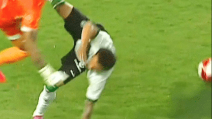 Atacante do Coritiba sofre fratura no braço em jogo do Paranaense 2026