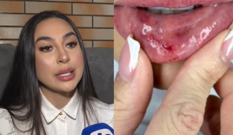 Dentista vítima de tortura em Pinhais enfrenta sequelas físicas e psicológicas um mês após agressão