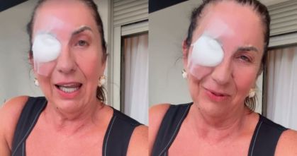 Mãe de Virginia Fonseca explica cirurgia no olho esquerdo