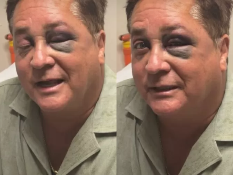 Leonardo diverte ao relembrar queda e fratura no rosto durante viagem ao Pantanal