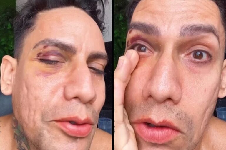 Agressão a jovem vestido de drag queen no Carnaval de Olinda evidencia intolerância