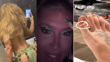 Virginia Fonseca revela machucados após ensaios na Grande Rio