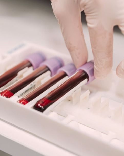 Oncologia personalizada revoluciona tratamento do câncer colorretal