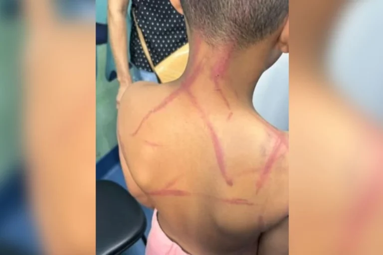 Pastores são presos suspeitos de torturar criança de 9 anos no Rio de Janeiro