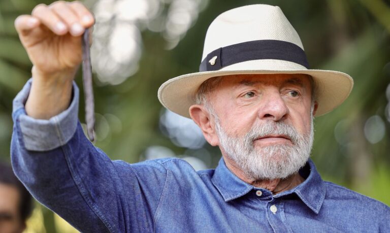 Lula realiza procedimento para retirar excesso de pele e tratar tendinite em São Paulo