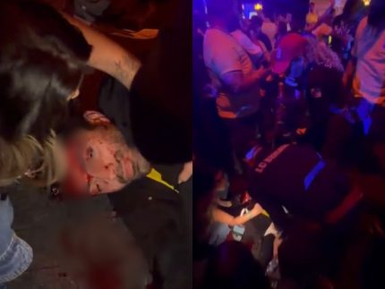 Festa no Rio: organizadores refutam relato de lotação após agressão