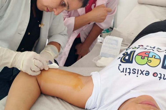 Paraná treina profissionais para ampliar implante contraceptivo