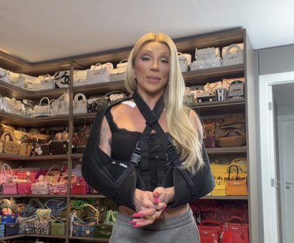 Maya Massafera faz cirurgia inédita para diminuir costas
