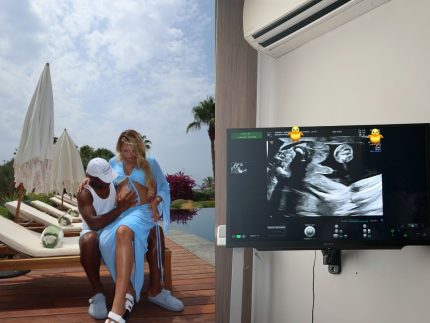 Endrick compartilha ultrassom e anuncia primeiro filho