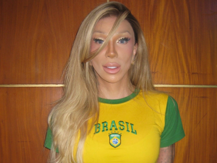 Cirurgia inédita de redução de costas realizada em Maya Massafera