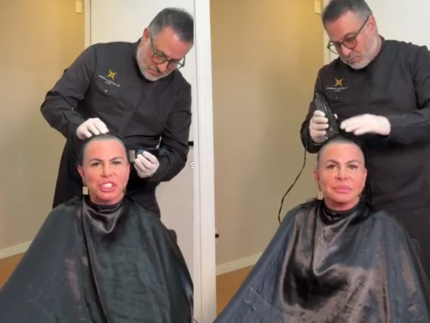 Gretchen raspa a cabeça antes de transplante capilar