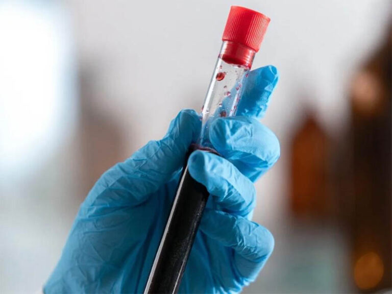 Médicos alertam que exames normais nem sempre indicam boa saúde